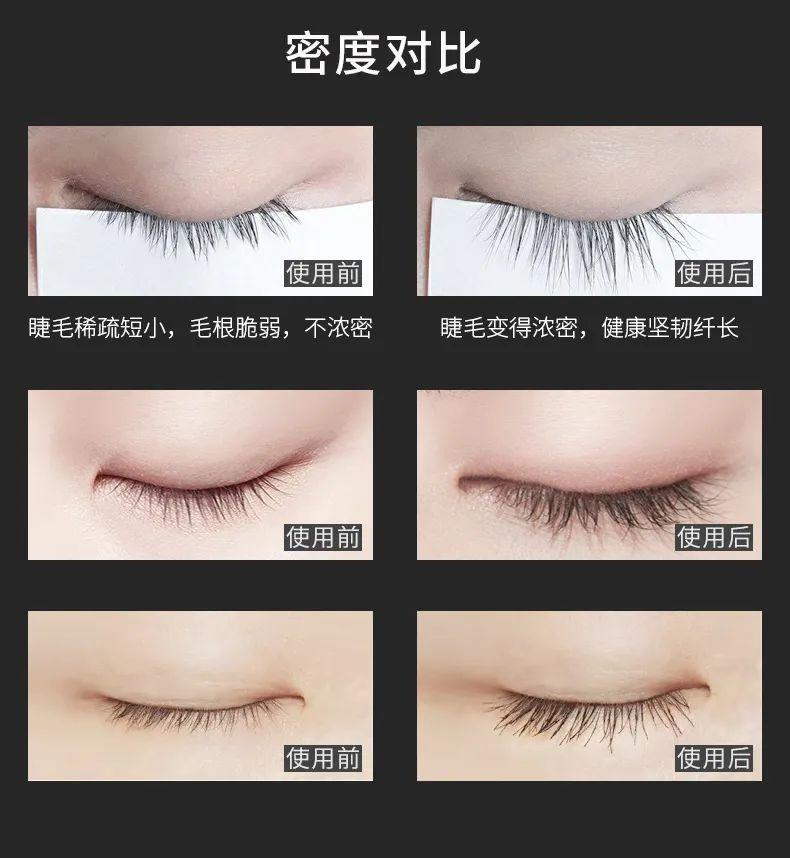 快扔掉睫毛膏和假睫毛，睫毛浓密纤长的黑科技来了，亲测有效 