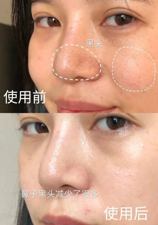 @知书先生粉丝 | HFP内购福利，限量开抢！ 